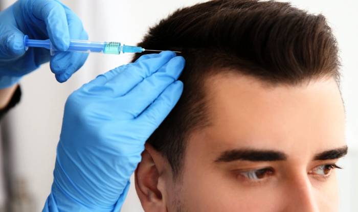 کربوکسی تراپی مو چیست